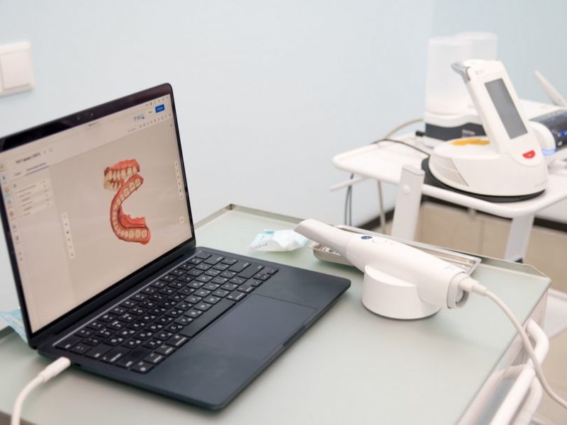 Протезирование и имплантация