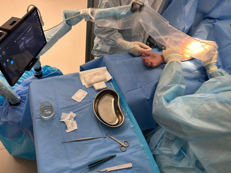 Лечение пациентов с лацертус-фиброзус синдромом