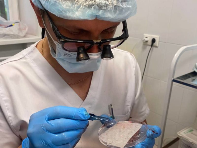 Трансплантация волос головы в Клиниках СамГМУ