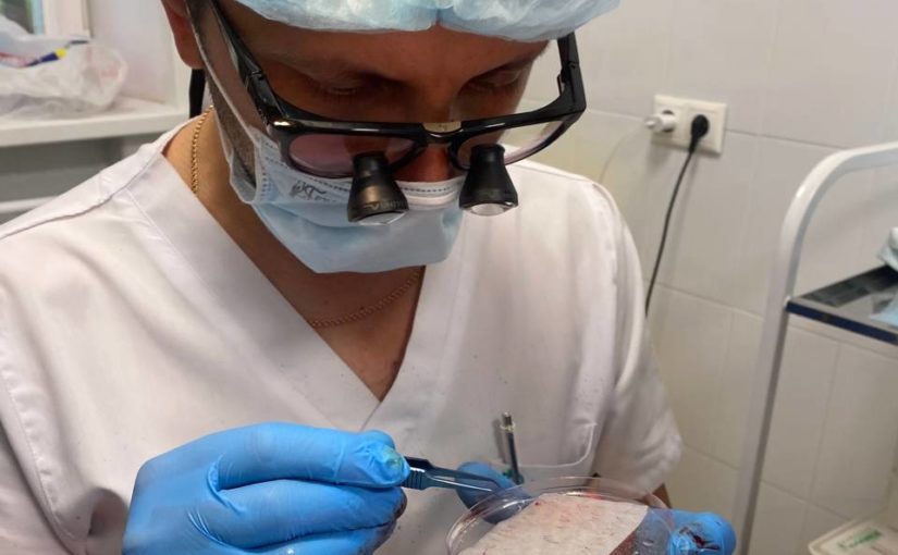 Трансплантация волос головы в Клиниках СамГМУ