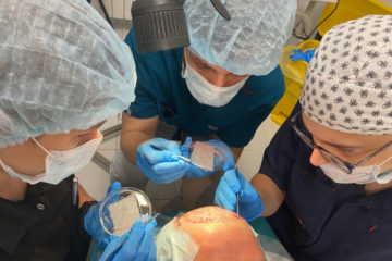 В Клиниках СамГМУ начали выполнять операции по пересадке волос