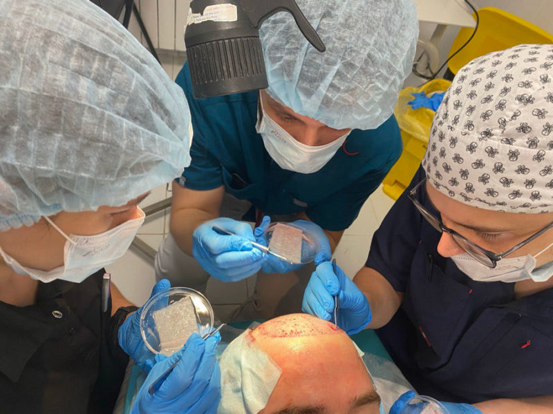 В Клиниках СамГМУ начали выполнять операции по пересадке волос