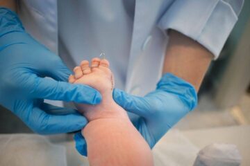 В СамГМУ спасают ногу двухмесячному пациенту с редкой формой гемимелии