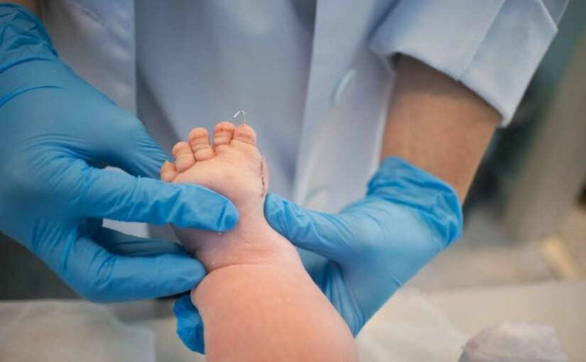 В СамГМУ спасают ногу двухмесячному пациенту с редкой формой гемимелии